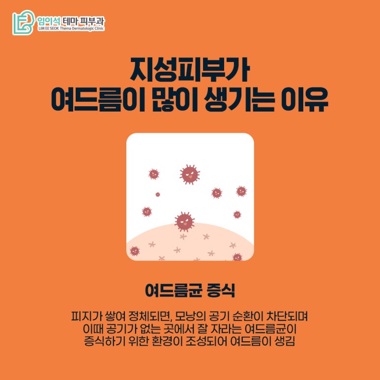 임이석테마피부과 피부 타입별 여드름관리법 <지성피부편> 관련 이미지 5