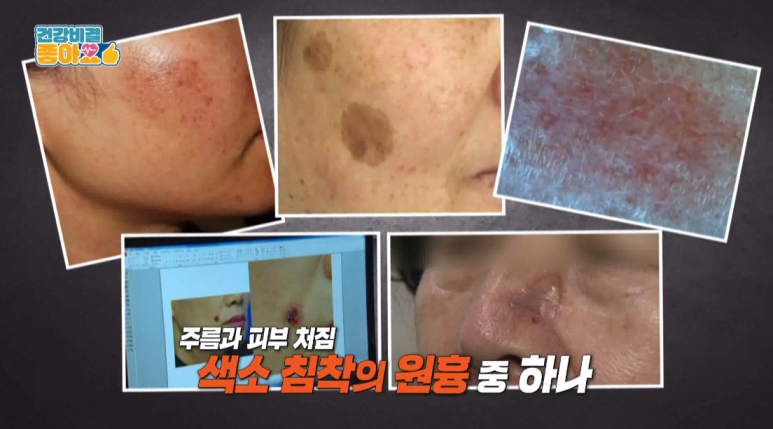 임이석원장, 관련 이미지 4