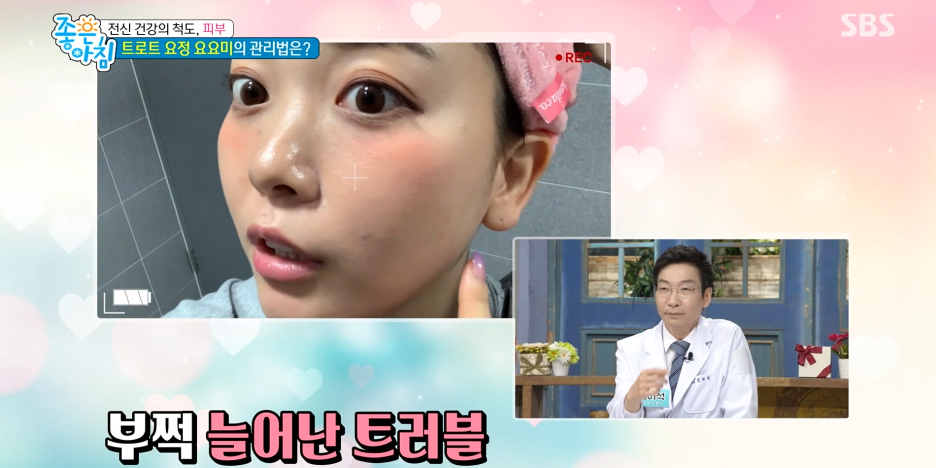 임이석원장 "요요미의 피부관리법" SBS 좋은아침 출연 관련 이미지 2