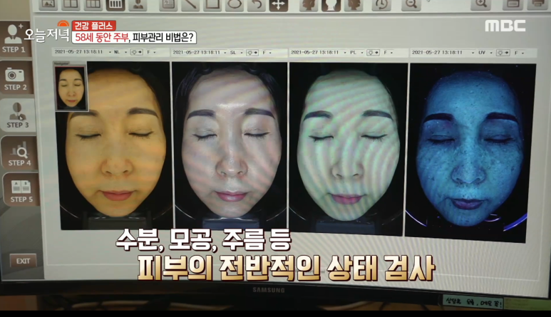 Imiseok Theme Dermatology Clinic, Director Imiseok on MBC image 3