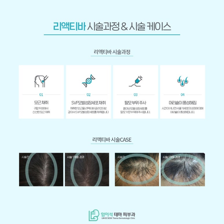 모발이식 없이 세포 재생 탈모치료 프로그램 관련 이미지 4