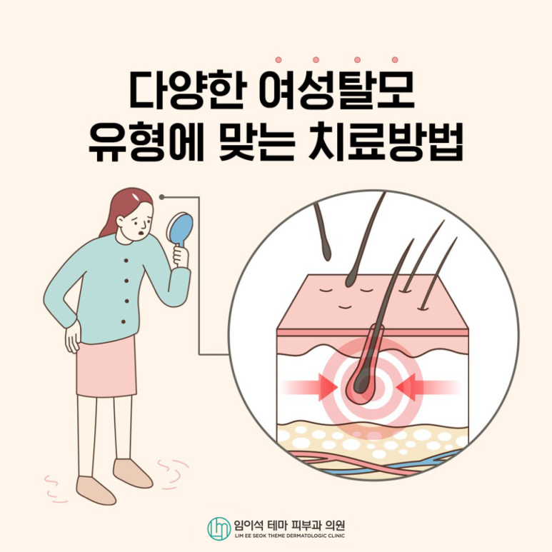 다양한 여성탈모 유형에 따른 치료방법 관련 이미지 2