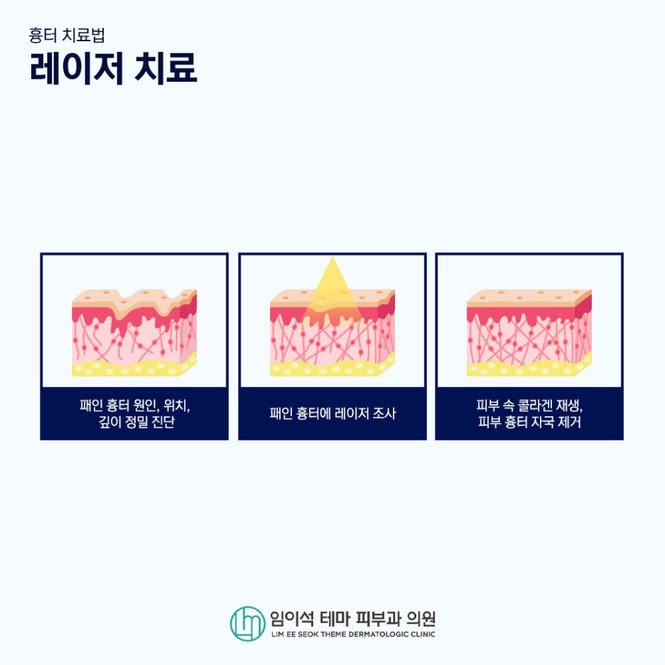 Various Scar Removal Methods Using Lasers image 7