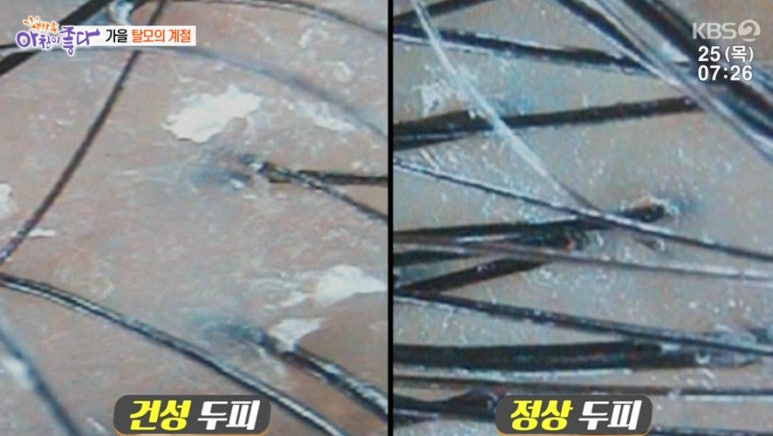 KBS 2TV 생방송 아침이 좋다 관련 이미지 5