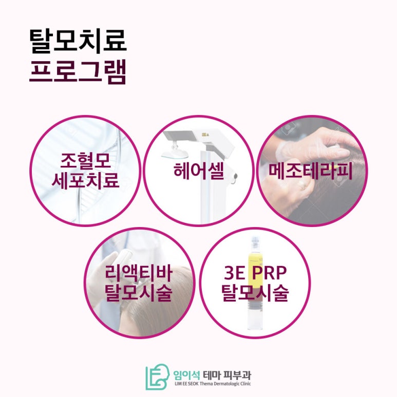 Effective Treatment Methods According to the Causes and Types of Female Hair Loss image 5