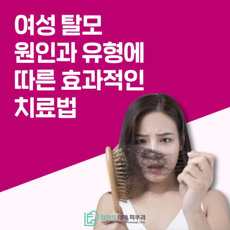 Effective Treatment Methods According to the Causes and Types of Female Hair Loss image 2