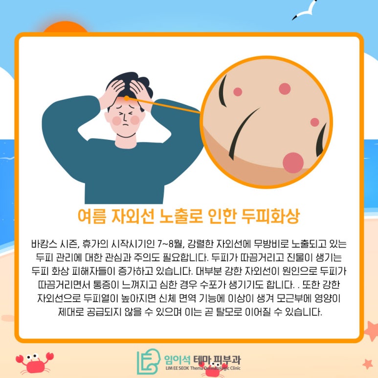 임이석테마피부과에서 알려드리는 여름철 두피 화상 주의 관련 이미지 4