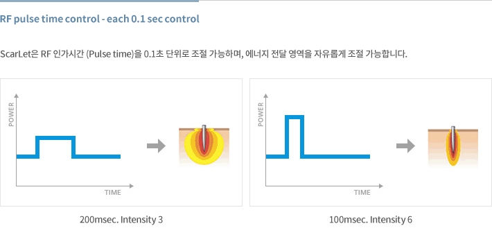 모공축소시술 관련 이미지 4