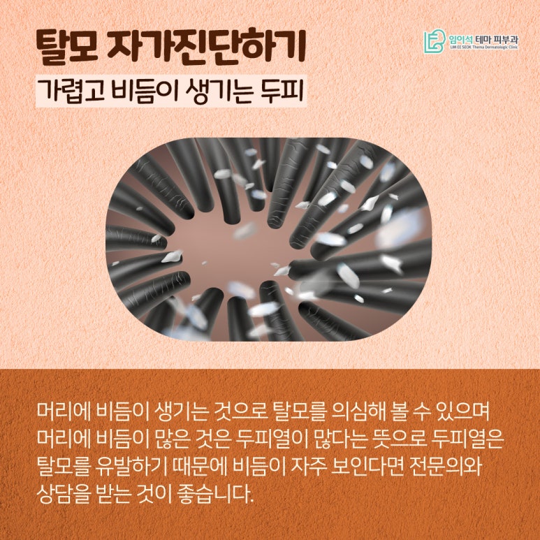 혹시, 나도 탈모일까? 신사피부과 탈모자가진단법 관련 이미지 3