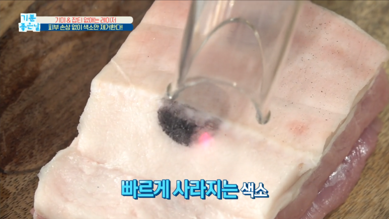 임이석테마피부과 기미를 없애는 법, 기미 레이저 전후 공개! MBC 기분좋은날 출연 관련 이미지 15