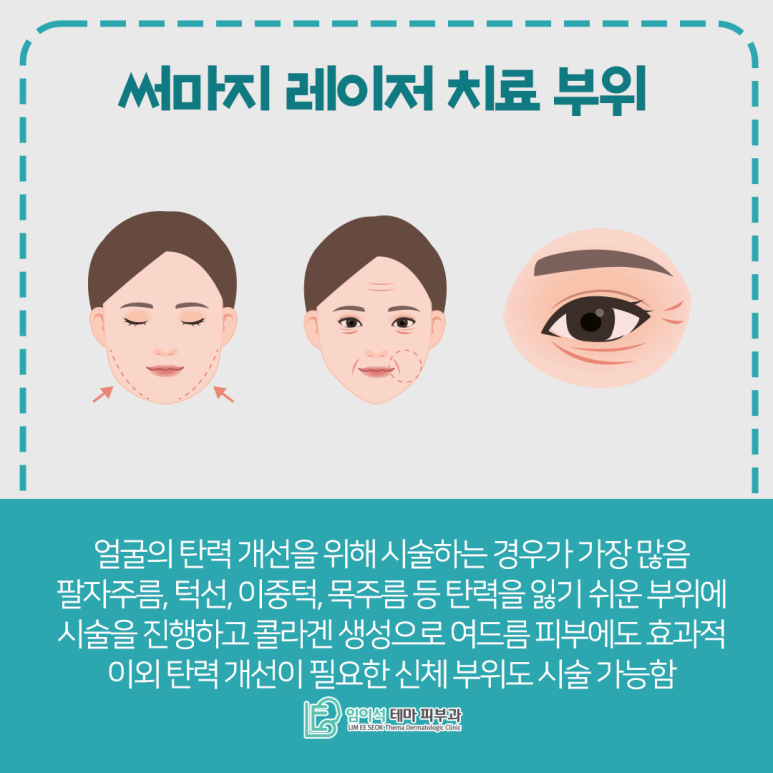 Advantages and Treatment Process of Thermage Laser at Imi-seok Dermatology image 4