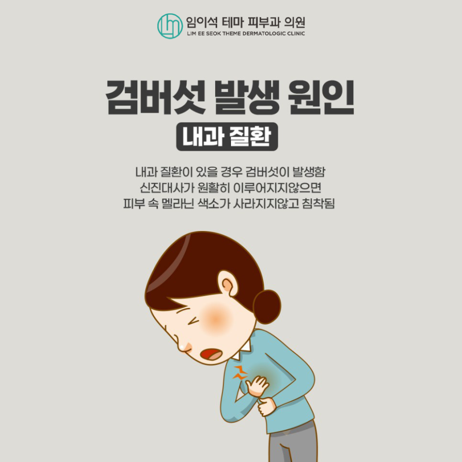 레이저를 이용한 검버섯 치료방법과 예방법 관련 이미지 5