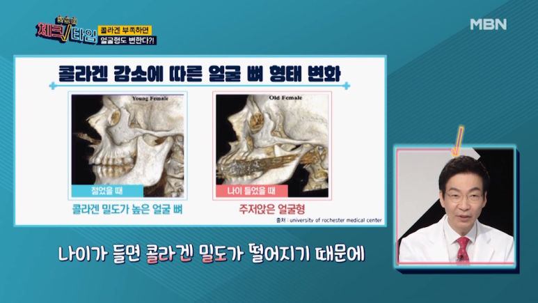 Director Im Eiseok: “The Secret to Looking Young and Living Long” Appearing on MBN’s Another Check Time image 18