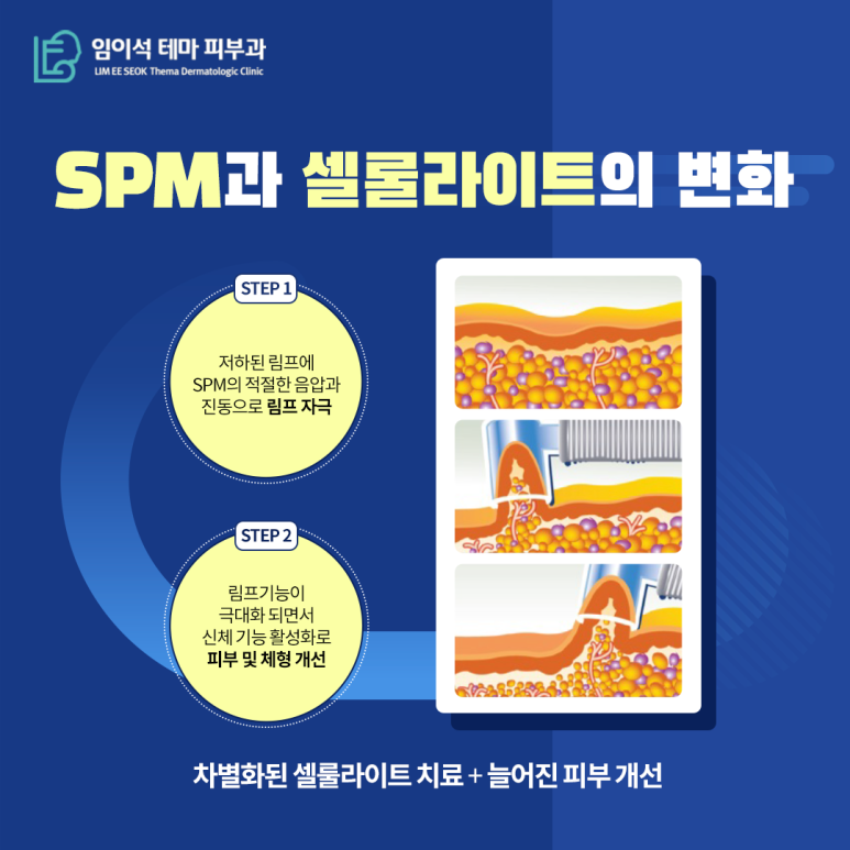 임이석테마피부과, 메디컬 스킨케어 림프마사지 관련 이미지 5