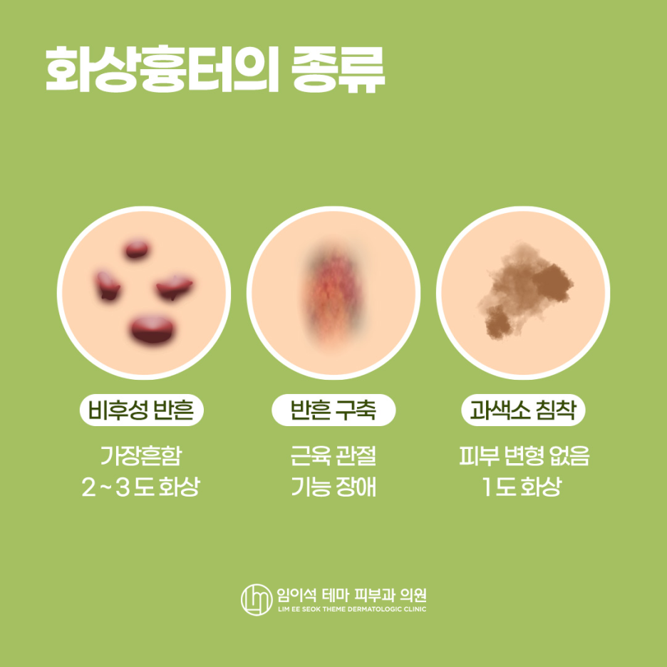 정신적 스트레스를 주는 화상흉터의 종류와 치료법 관련 이미지 4
