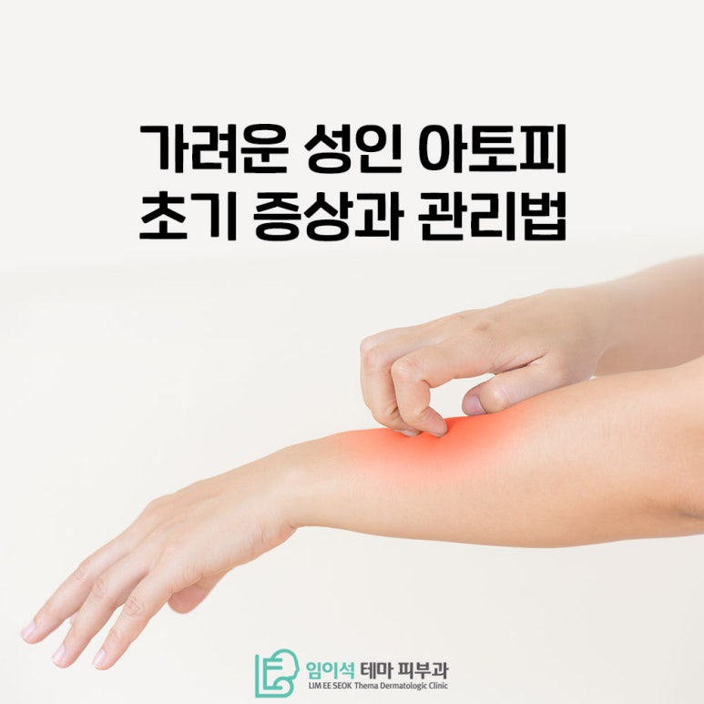 임이석테마피부과에서 알려드리는 성인아토피 초기 증상과 관리법 관련 이미지 1