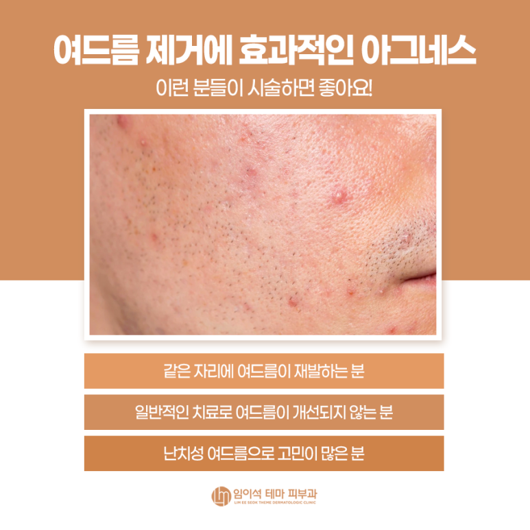 임이석 테마피부과 NEW 시술 & 인기 레이저 관련 이미지 6