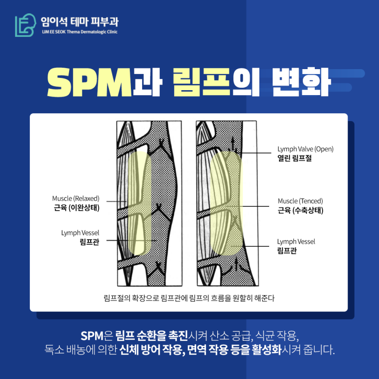 임이석테마피부과, 메디컬 스킨케어 림프마사지 관련 이미지 4