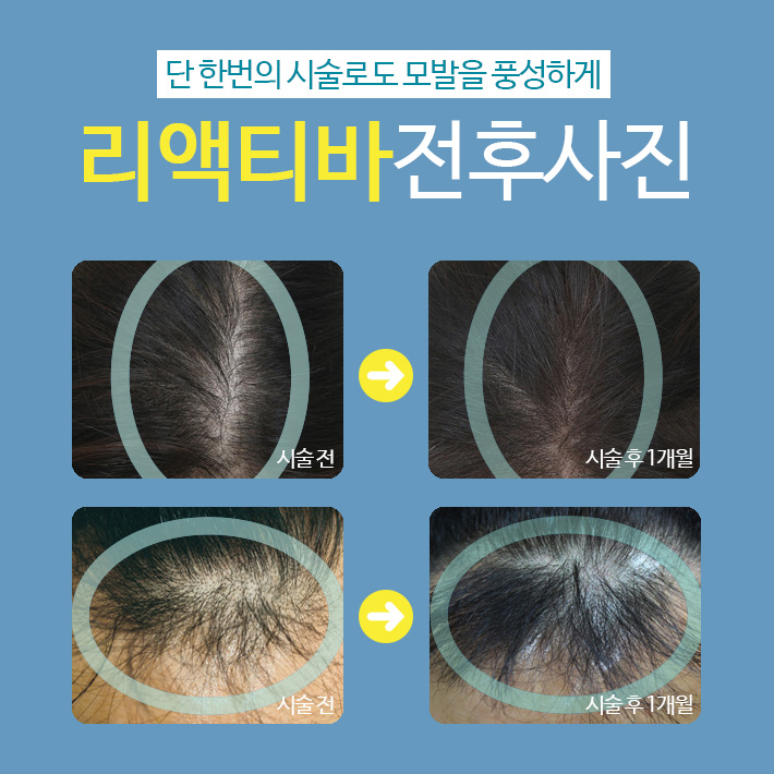 Imiseok Theme Dermatology Hair Loss Treatment Program image 5
