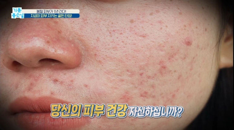 임이석 원장 관련 이미지 1