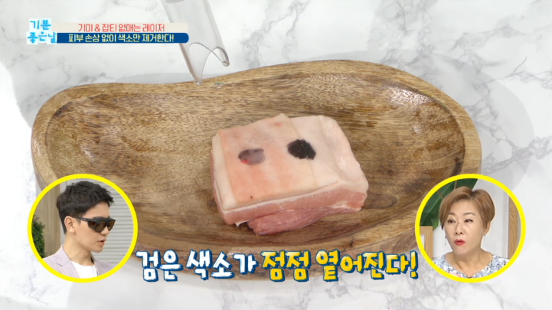 임이석테마피부과 기미를 없애는 법, 기미 레이저 전후 공개! MBC 기분좋은날 출연 관련 이미지 13