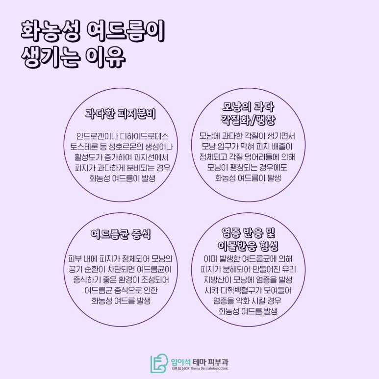 Pustular Acne Treatment, as Introduced by Imi-seok Theme Dermatology Clinic. image 4