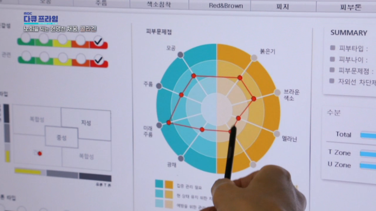 임이석 원장 "노화를 막는 현명한 채움 콜라겐" MBC 다큐프라임 출연 관련 이미지 4