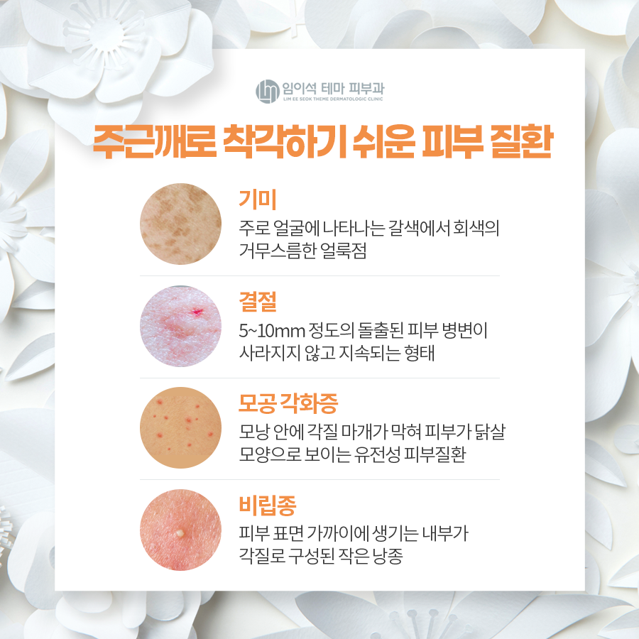 주근깨 개선을 위한 치료법 관련 이미지 5