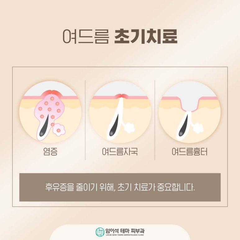 Customized Acne Laser Treatment at Imi Seok Theme Dermatology, Sinsa Station Dermatology image 3