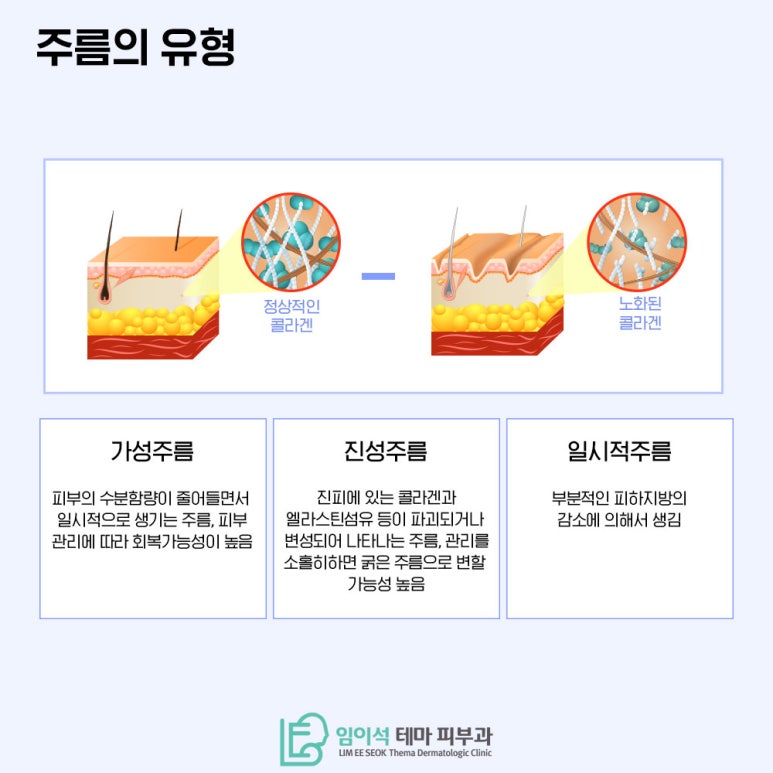 임이석테마피부과에서 알려드리는 여름철 피부관리, !에어컨 바람 피부건조 주의! 관련 이미지 4