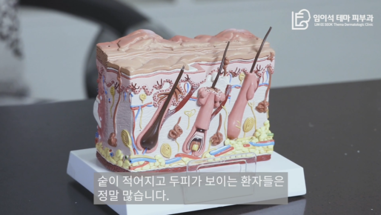 [임이석테마피부과 유튜브 Dr. 임이석 채널]  혹시 나도 탈모?! 탈모자가 진단법으로 확인해보아요! 관련 이미지 10