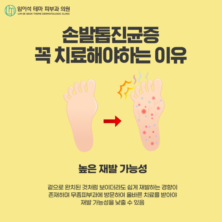 손발톱진균증, 효과적인 치료법은? 관련 이미지 7