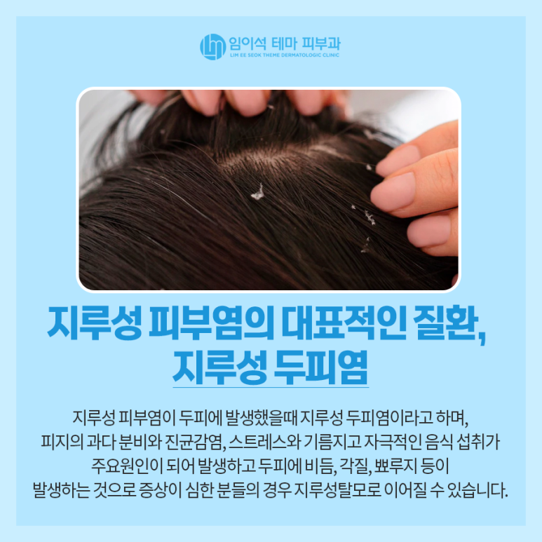 Effective Care Methods for Seborrheic Scalp Dermatitis and Seborrheic Dermatitis image 5