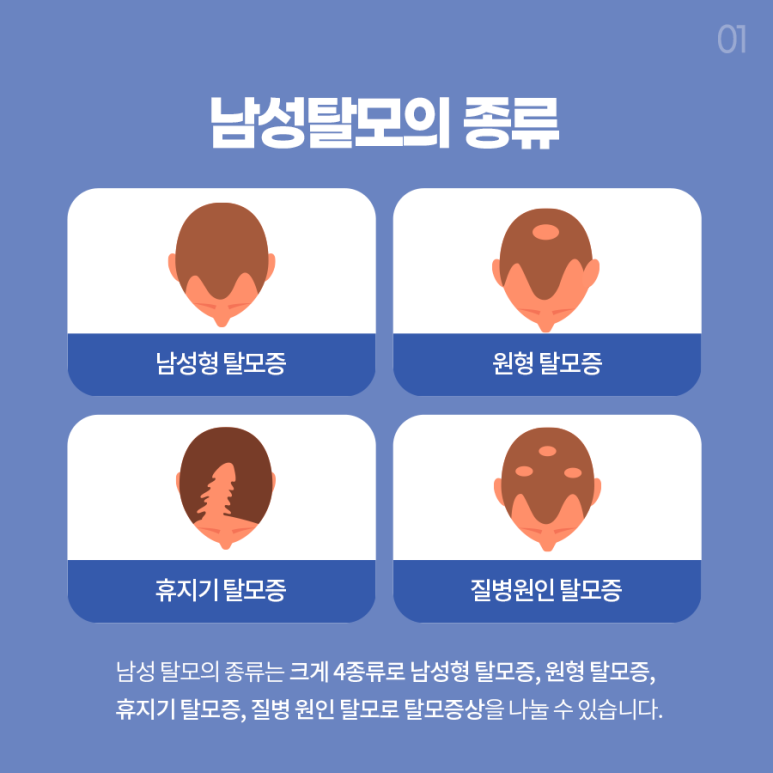 남성탈모치료 좋은 선택지가 될 수 있습니다. 관련 이미지 3