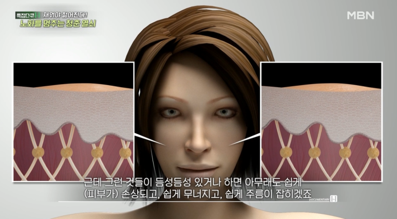 신사역피부과, 피부과전문의 임이석 - MBN 특집다큐H 방송 출연 관련 이미지 2