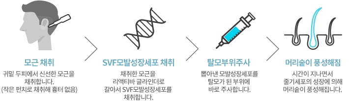머리숱 풍성하게 관련 이미지 2