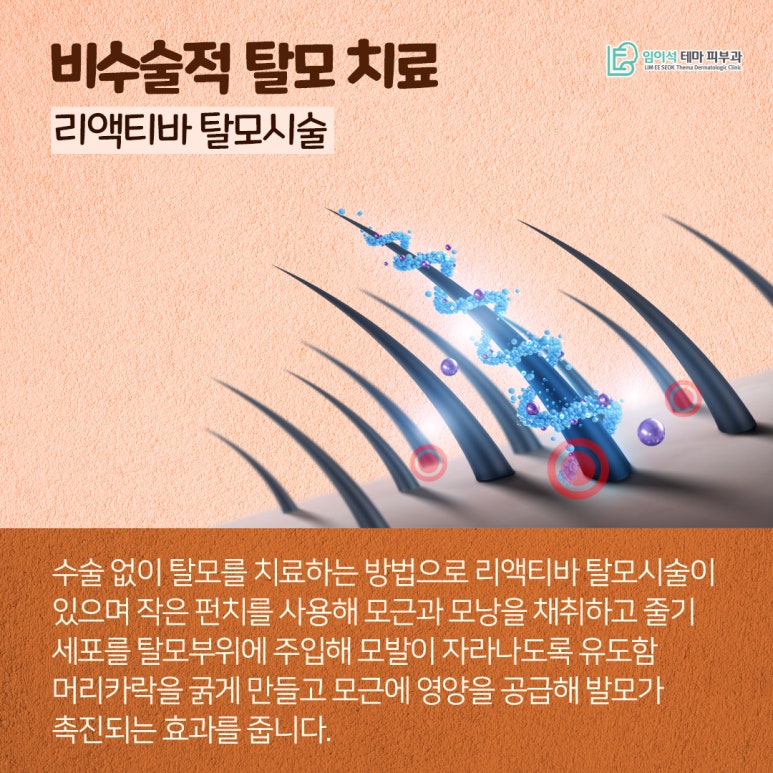 혹시, 나도 탈모일까? 신사피부과 탈모자가진단법 관련 이미지 8