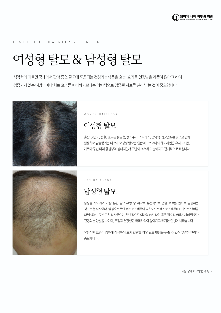 우수수 떨어지는 머리카락.. 치료가 될까요? (임이석테마피부과 탈모치료) 관련 이미지 2