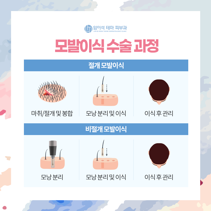 나에게 딱 맞는 모발이식 수술 방법 찾기 ・ 임이석테마피부과 관련 이미지 6