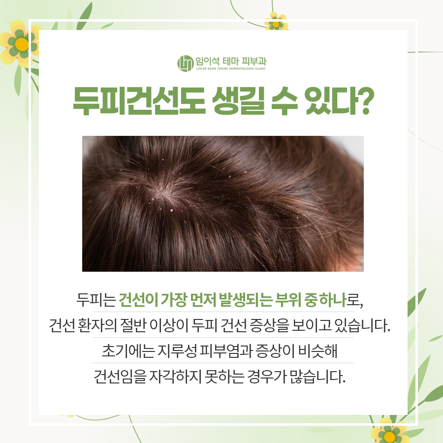 건조한 피부, 피부 건선이 생기는 이유와 치료 방법 관련 이미지 5