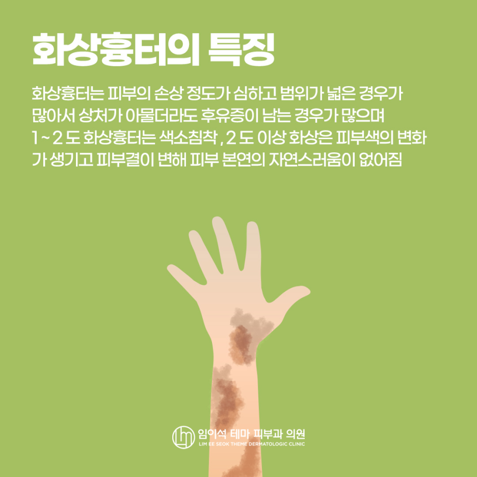 정신적 스트레스를 주는 화상흉터의 종류와 치료법 관련 이미지 3