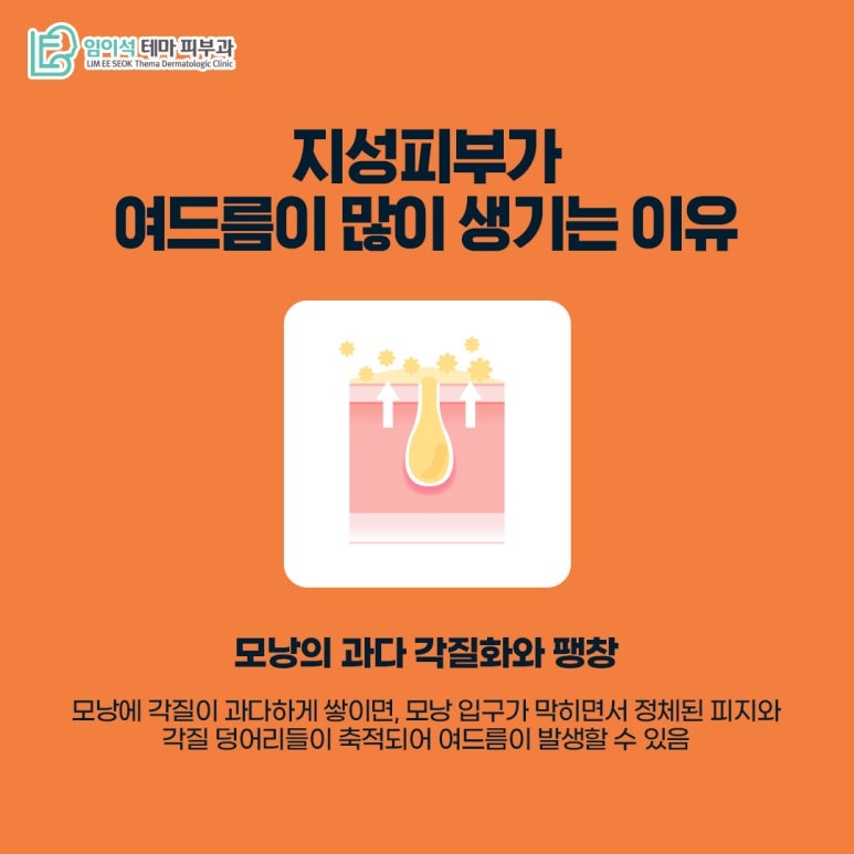임이석테마피부과 피부 타입별 여드름관리법 <지성피부편> 관련 이미지 4
