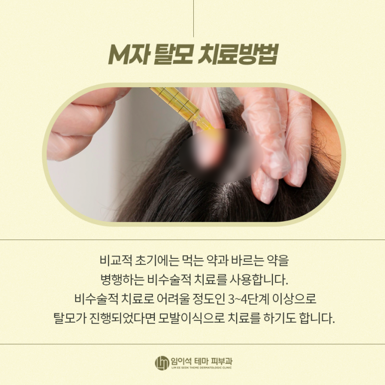 Alopecia Areata, M-Shaped Hair Loss Symptoms, and Self-Diagnosis Methods for Hair Loss image 7