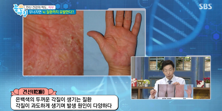 임이석원장 "건강한 피부세포가 전신을 지킨다!" SBS 좋은아침 출연 관련 이미지 13