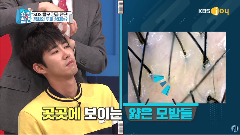 KBS Joy Shopping’s Pointers <A Full Breakdown of Anti-Hair-Loss Items> image 13