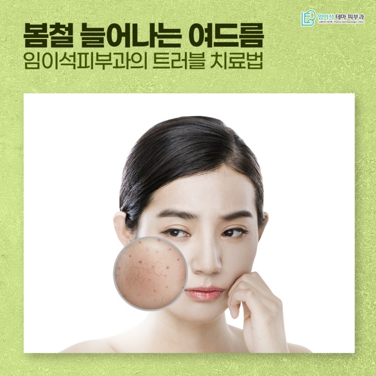 Spring Acne Is on the Rise! Lee Mi-seok Dermatology’s Solutions for Troubled Skin image 2