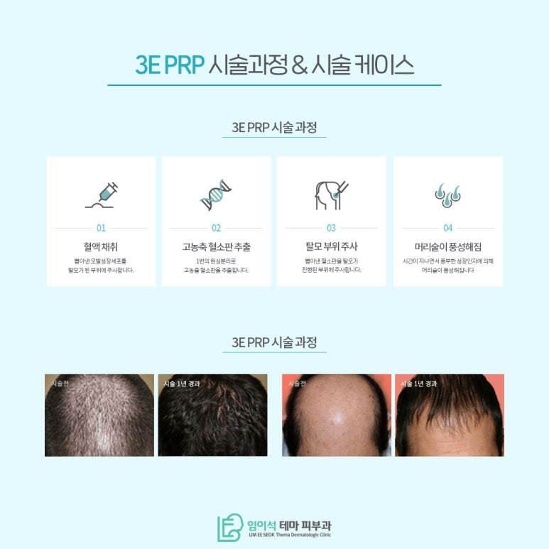 모발이식 없이 세포 재생 탈모치료 프로그램 관련 이미지 5