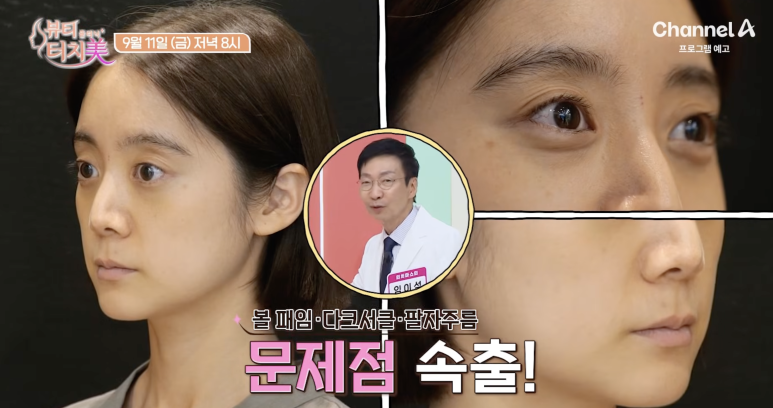 임이석 원장이 알려주는 피부 이야기 - 8화 우혜림편|채널 A 뷰티클리닉 터치미 9월 11일 방송 관련 이미지 6