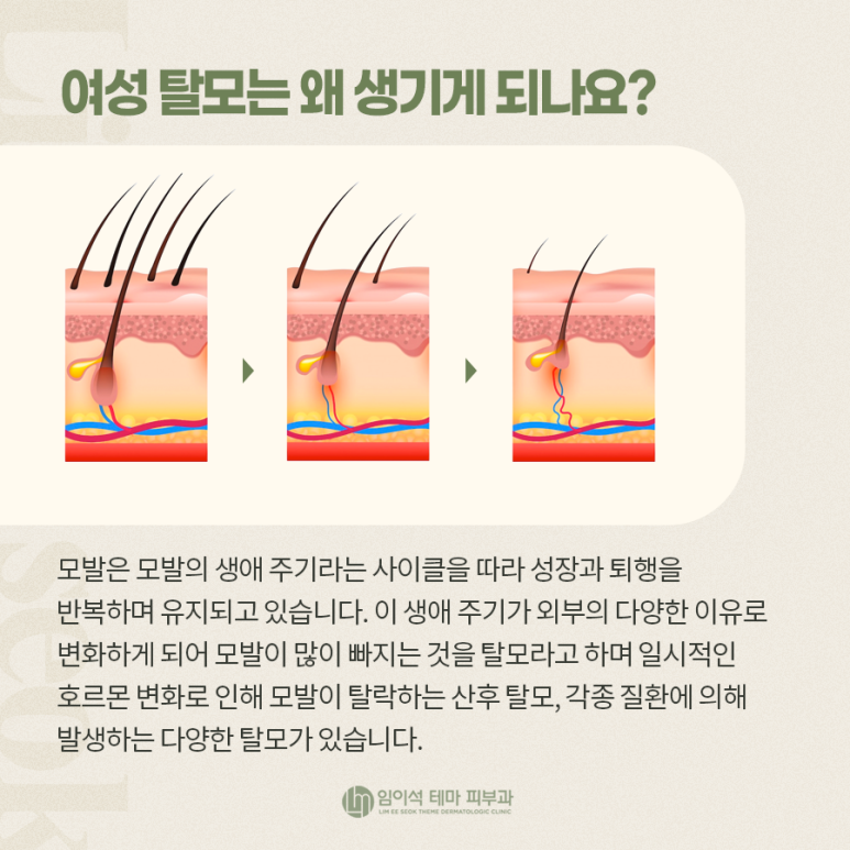 여성탈모, 각질관리가 필요한 이유 관련 이미지 5