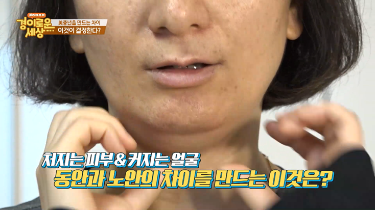 강남 피부과전문의 임이석, OBS [경이로운세상] 방송출연 관련 이미지 1